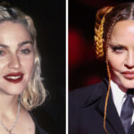 20 famosos que se han hecho cirugías plásticas